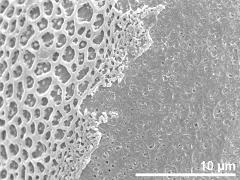 aperture detail,exine surface