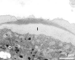 apertural area of pollen wall, intine (I)