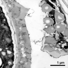 pollen wall (left) and tapetum wall with Ubisch bodies (right)