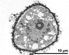 cross section of microspore
