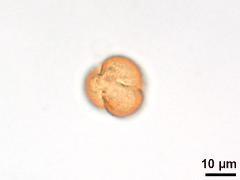 polar view,acetolyzed pollen