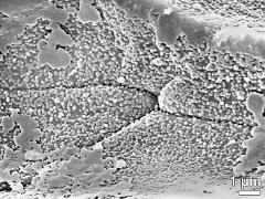 exine surface (basal)