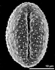 dry pollen grain in equatorial view