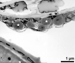 pollen wall (left) and tapetum cells with Ubisch bodies (asterisks)