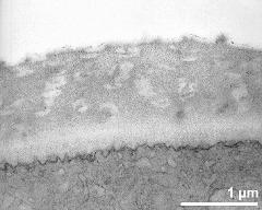 apertural area of pollen wall