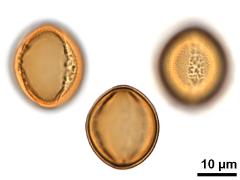 acetolyzed pollen,equatorial view