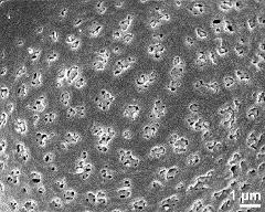 exine surface