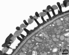 pollen wall; interapertural area