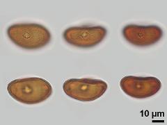 acetolyzed pollen,equatorial view