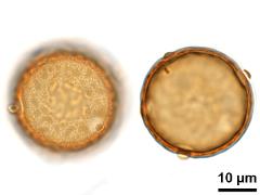 acetolyzed pollen