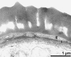 interapertural area of pollen wall, intine (I), endexine (E)