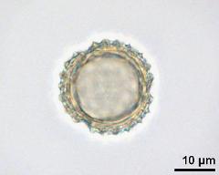 acetolyzed pollen, optical section