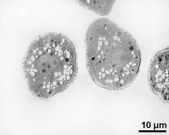 pollen grains in cross section