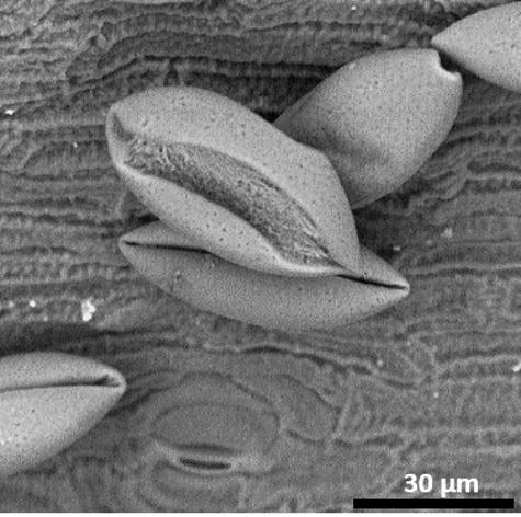 dry pollen,equatorial view