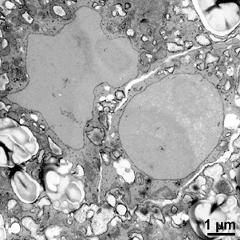 generative cell (right) and vegetative nucleus