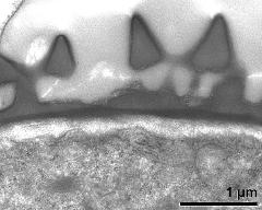 interapertural area of pollen wall