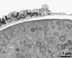 pollen wall at transition of aperture and interapertural region