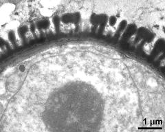 pollen wall, interapertural area, vegetative nucleus