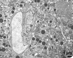 vegetative nucleus (left) and generative cell; stacked endoplasmatic reticulum (right)