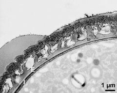 pollen wall, interapertural area, intine (I), endexine (E)