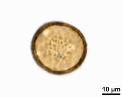 acetolysed pollen, optical section