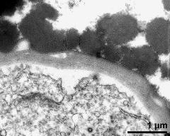 pollen wall of mature pollen grain