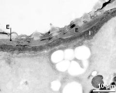 apertural area of pollen wall, intine (I), endexine (E)