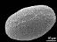 distal polar view