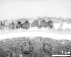 interapertural area fo pollen wall