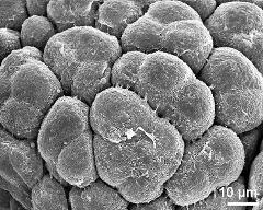 hydrated tetrads (forming massula)