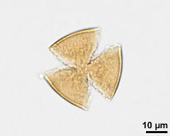 acetolyzed pollen, lower focus