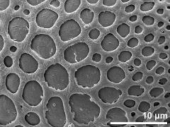 exine surface