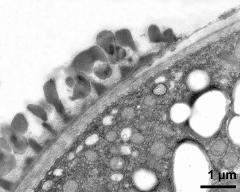 pollen wall at transition of aperture and interapertural area