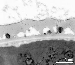 interapertural area of pollen wall