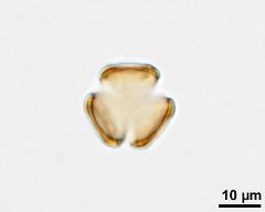 acetolysed pollen in polar view, lower focus