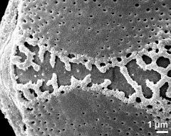 exine surface (equatorial area)