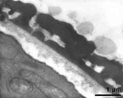 interapertural area of pollen wall