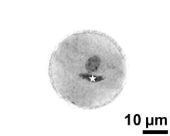 pollen grain with generative cell (asterisk) and vegetative nucleus