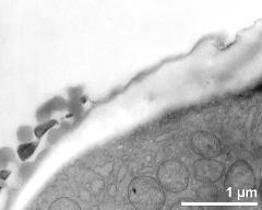 pollen wall at transition of aperture and interapertural area