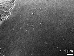 exine surface