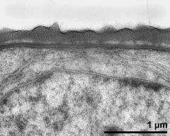 interapertural area of pollen wall