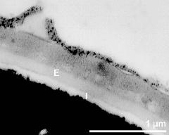 interapertural area of pollen wall, intine (I), endexine (E)