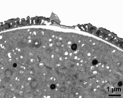 apertural area of pollen wall