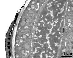 pollen wall, transition zone between aperture and interapertural area