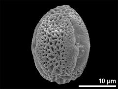 Equatorial view showing two apertures