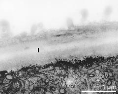 apertural area of pollen wall