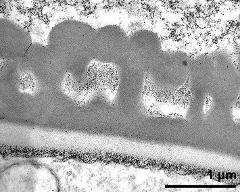 pollen wall after 2. pollen mitosis; primexine matrix in infratectum