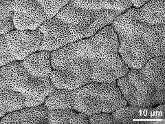 tetrads (forming massula)