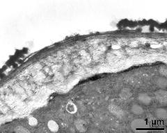 apertural area of pollen wall