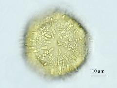 acetolyzed pollen,polar view